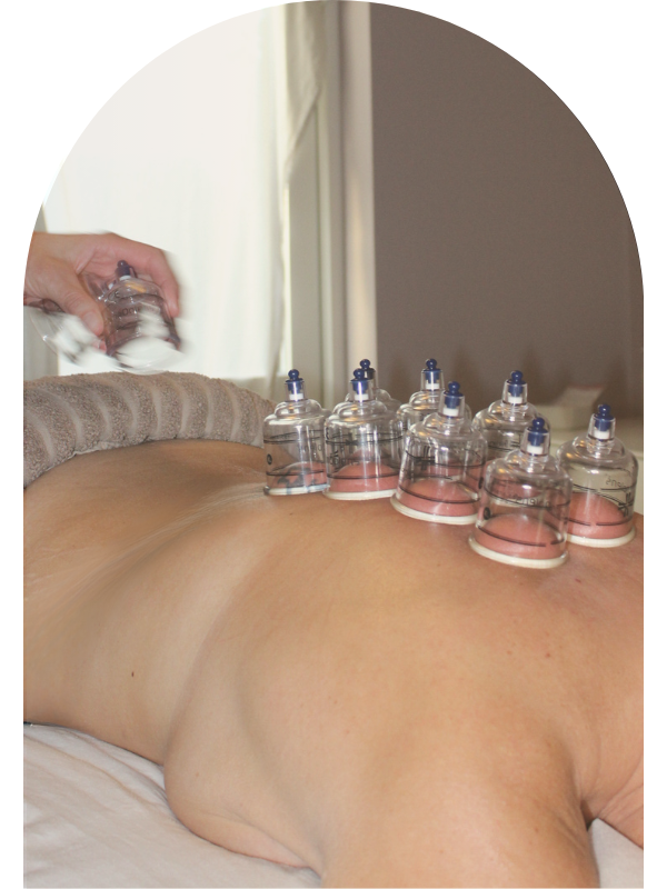 Cupping-kopper placeret på en klients ryg under behandling